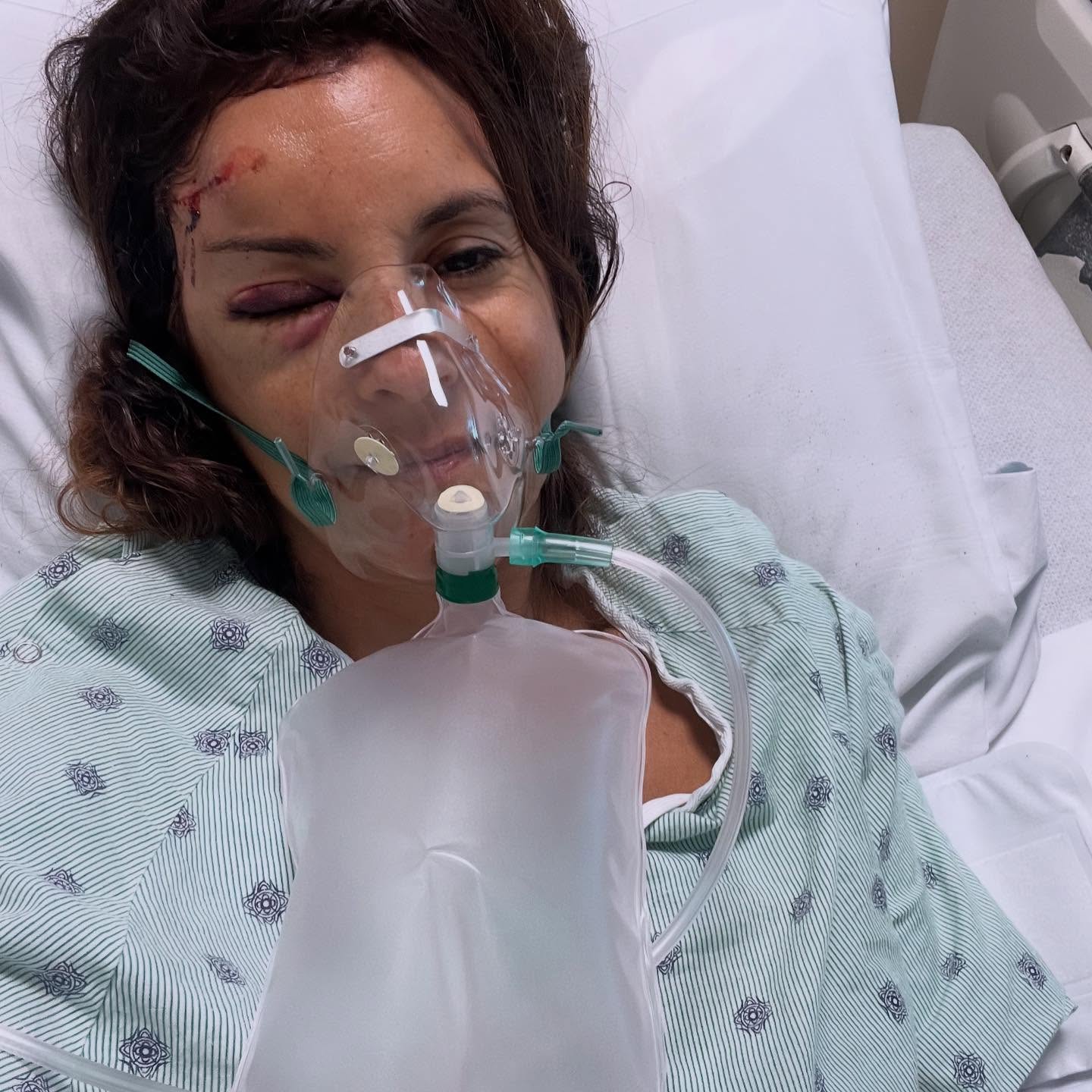 Марион Грожан после ДТП на велосипеде &copy; Соцсети